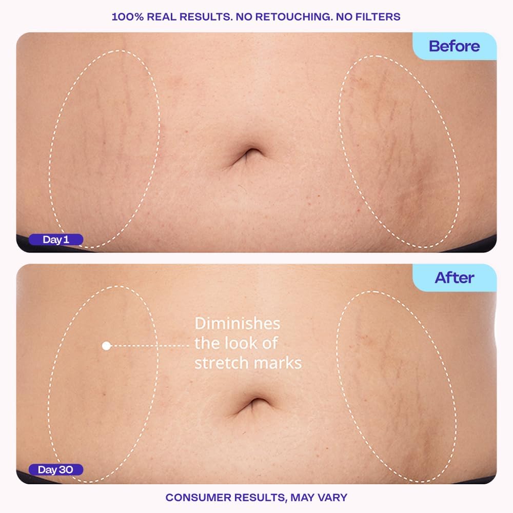 Tighten & Smooth Firming Belly Cream